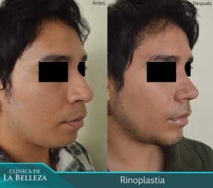 Clínica de la Belleza 23